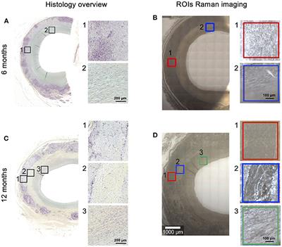 Marker-Independent Monitoring of in vitro and in vivo Degradation of Supramolecular Polymers Applied in Cardiovascular in situ Tissue Engineering